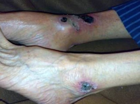 Oom Jan Left 2009-06-04