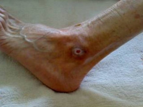 Oom Jan Left 2009-08-05