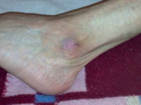 Oom Jan Left 2009-10-01