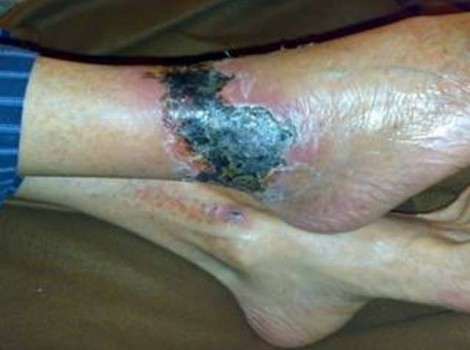 Oom Jan Right 2009-06-04 Testimonies