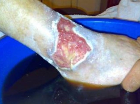 Oom Jan Right 2009-06-30 Testimonies