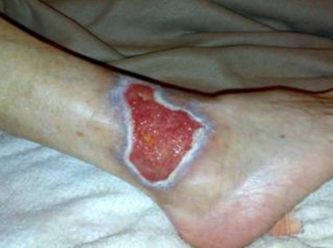 Oom Jan Right 2009-07-22 Testimonies