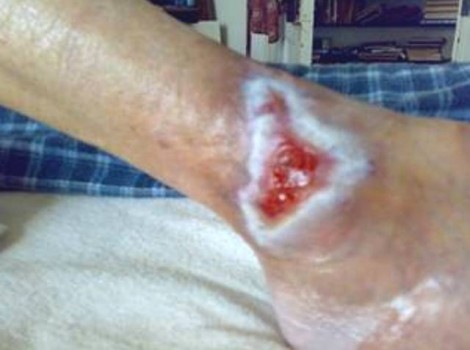 Oom Jan Right 2009-08-05 Testimonies