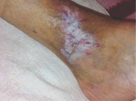 Oom Jan Right 2009-10-01 Testimonies